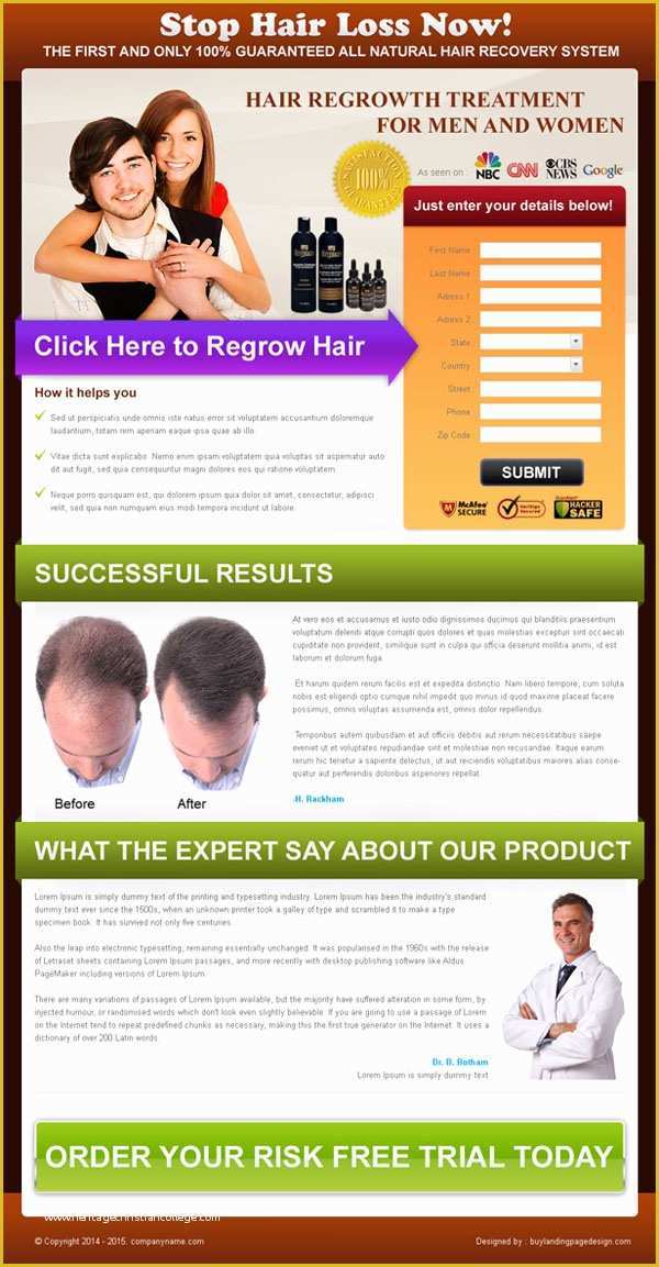 Free Lead Capture Page Templates Of Stop Hair Loss Lead Capture Lp 001