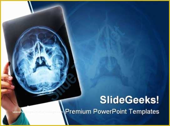 Free Neurology Powerpoint Templates Of Xray Medical Powerpoint Template 0610