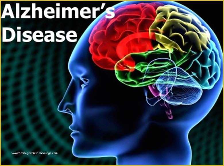 Free Alzheimer Powerpoint Template Of National Alzheimer ’s Disease Awareness Month Wright Patt