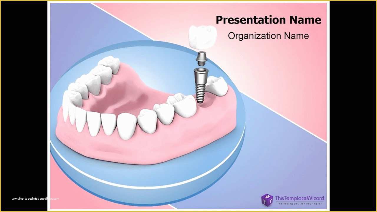 Free Animated Dental Powerpoint Templates Of Dental Implant Powerpoint Presentation Template